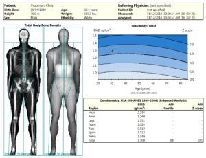 https://www.compositionid.com/wp-content/uploads/2018/11/dexa-scan-bmd-results-vrooman-300x230.png
