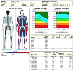 How to Read DEXA Scan Results - Composition ID